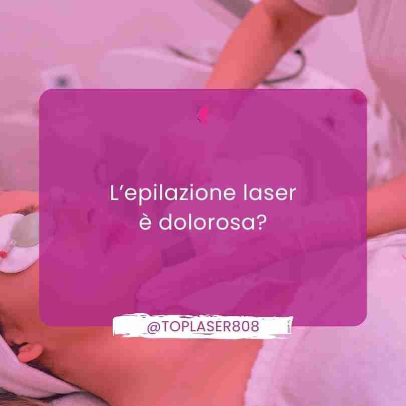 Epilazione laser e dolore